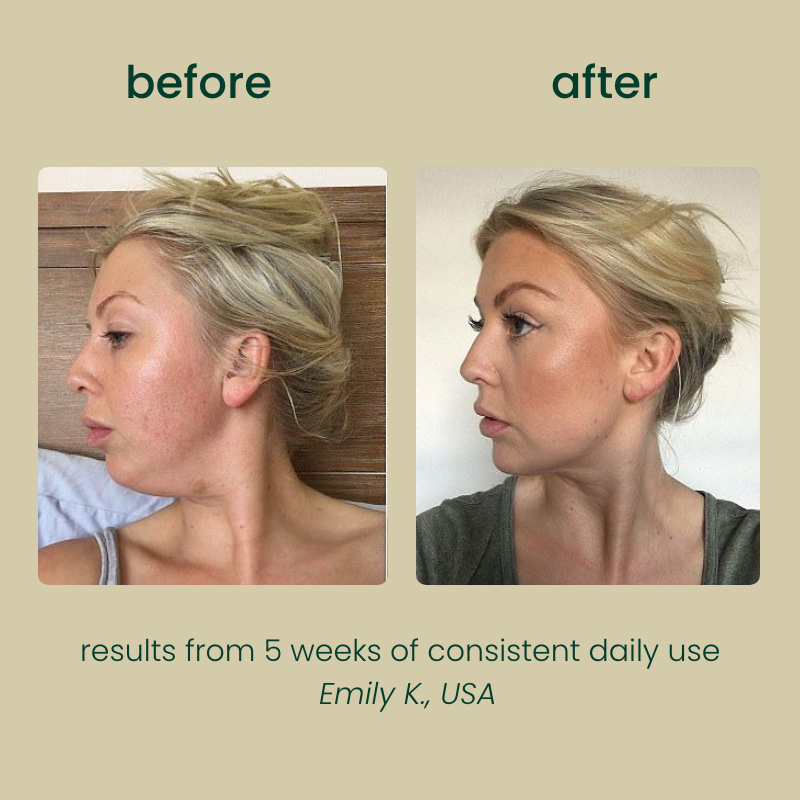 Avary™ Organic Lymphatic Drainage Drops
