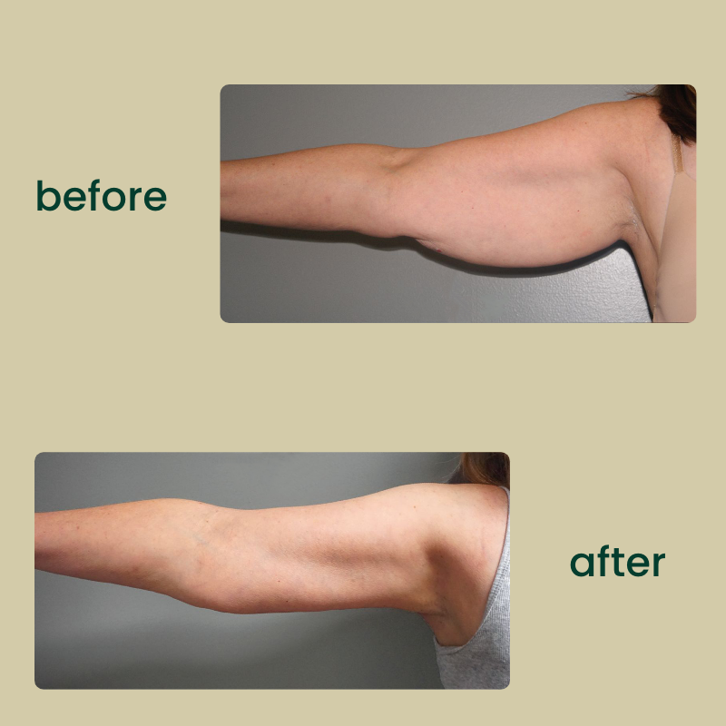 Avary™ Organic Lymphatic Drainage Drops